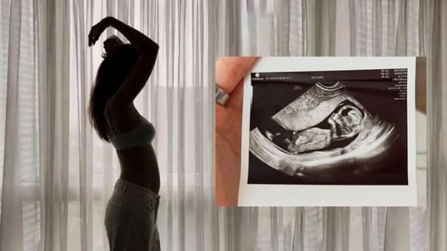 Celeste Cortesi announces pregnancy; fellow beauty queens celebrate the news