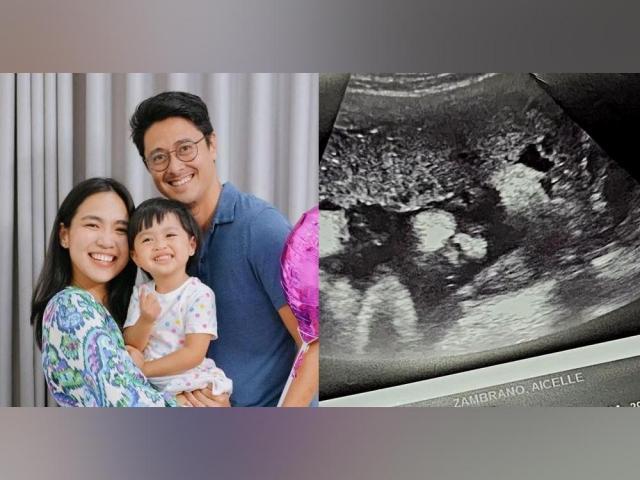 Aicelle Santos, Mark Zambrano, Zandrine