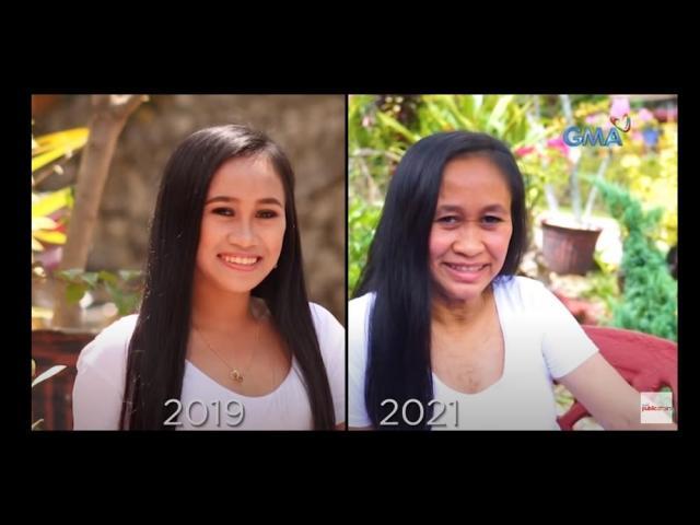 kapuso mo jessica soho progeria