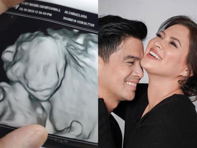 Sonogram of Lara Quigaman baby 