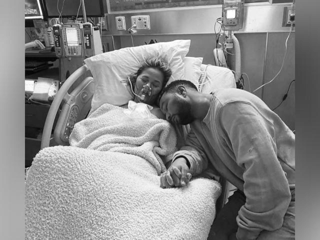 Chrissy Teigen in hospital