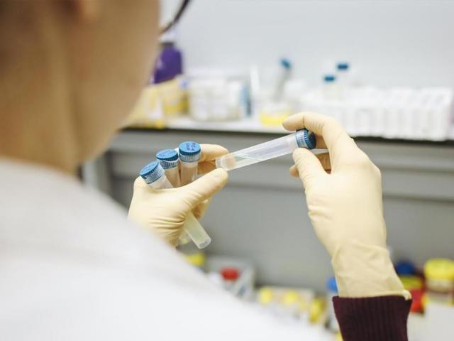 Saliva test for COVID-19 By Bong Godinez