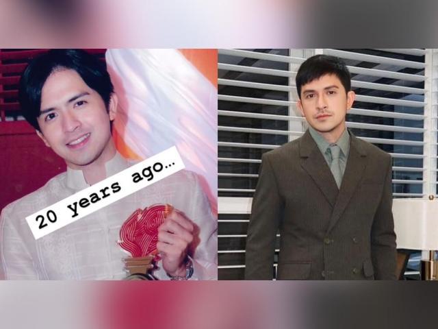 Dennis Trillo