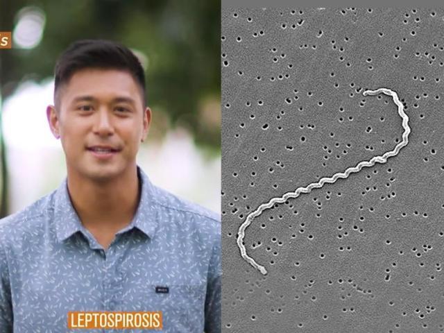 the healthy juan leptospirosis