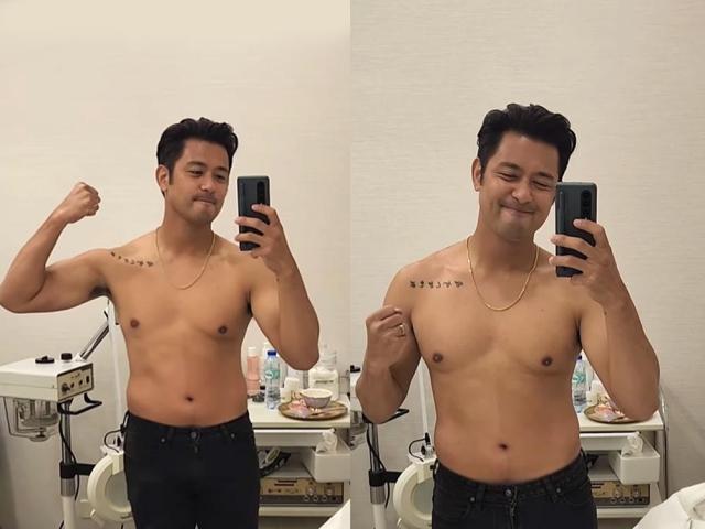 Rocco Nacino