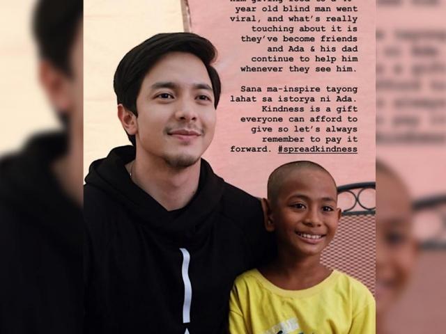 Kindess is a true gift according to Alden Richards