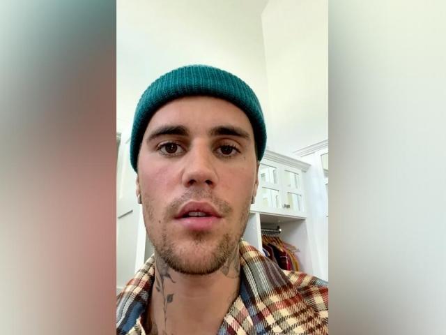 Justin Bieber facial paralysis