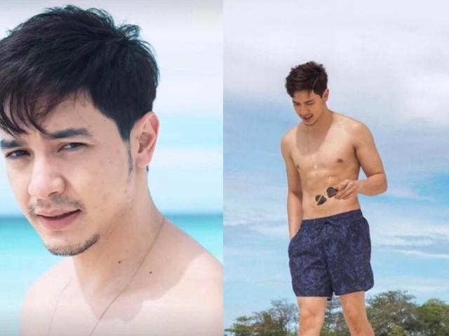 Alden Richards   
