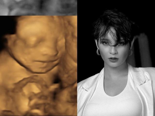 Ryza Cenon baby sonogram