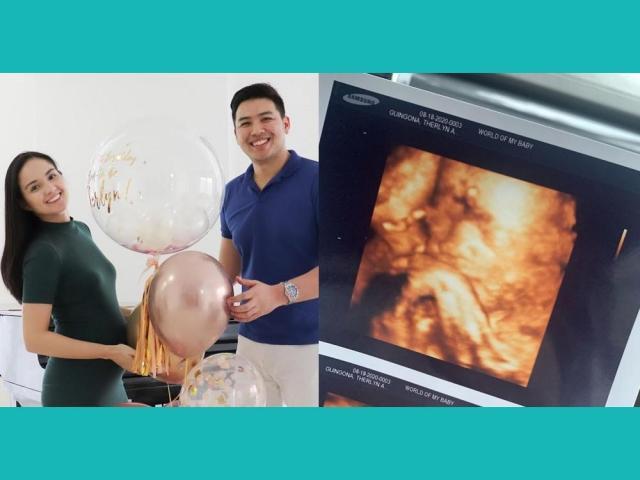 reese tuazon posts sonogram of baby