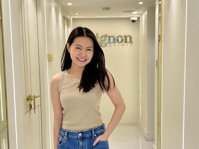 Barbie Forteza