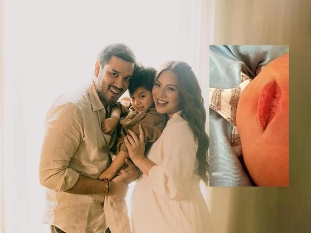 lips of a baby luane dy carlo gonzalez and jose christiano