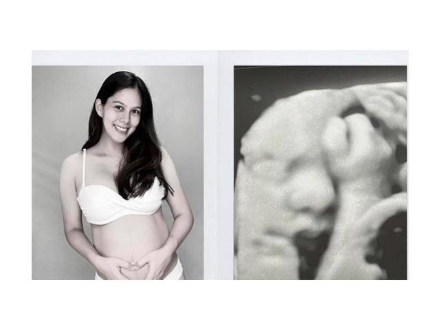 Vickie Rushton Jason Abalos Baby