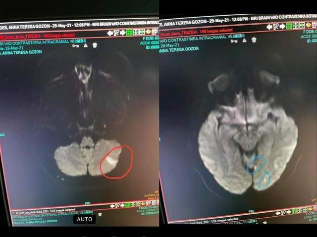 Annette Gozon Valdes