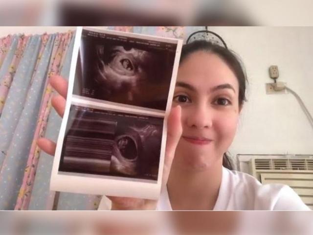 Vaness del Moral holding her sonogram