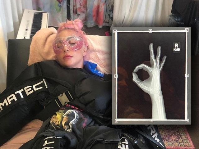 Lady Gaga falls off the stage