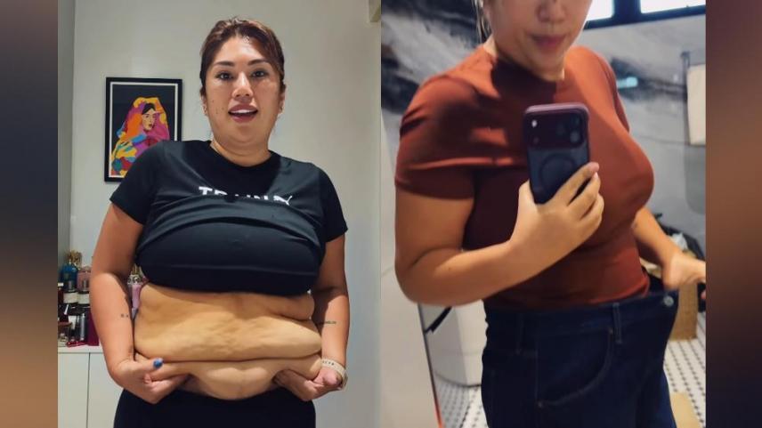 Eric Tai wife Rona Tai cosmetic surgery