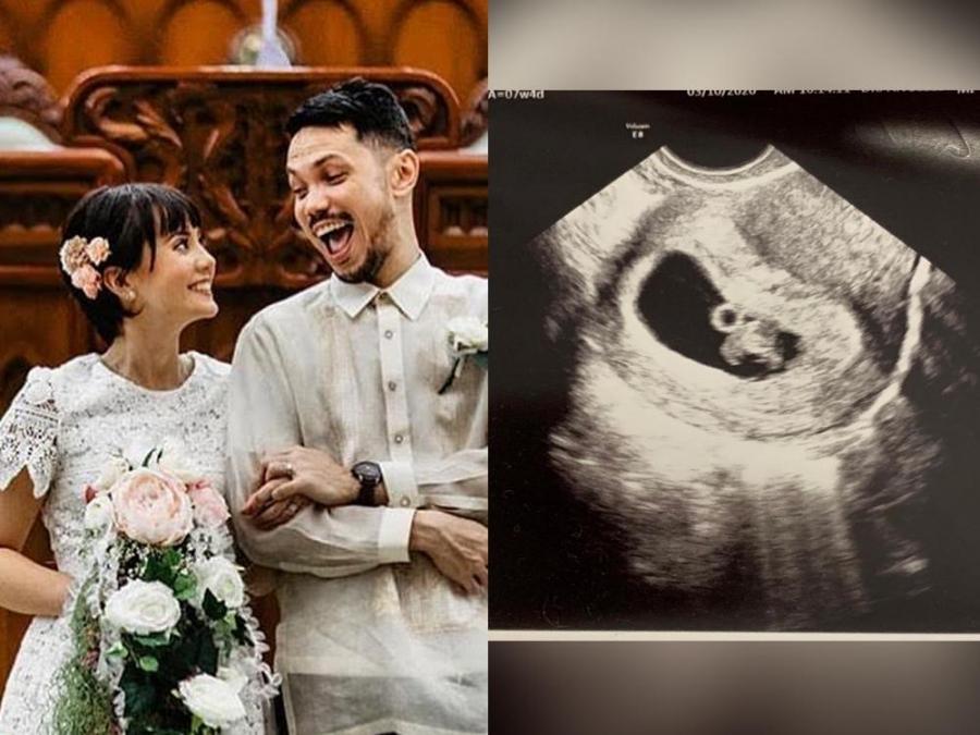 Diego Castillo and Nikki Cruz with ultrasound