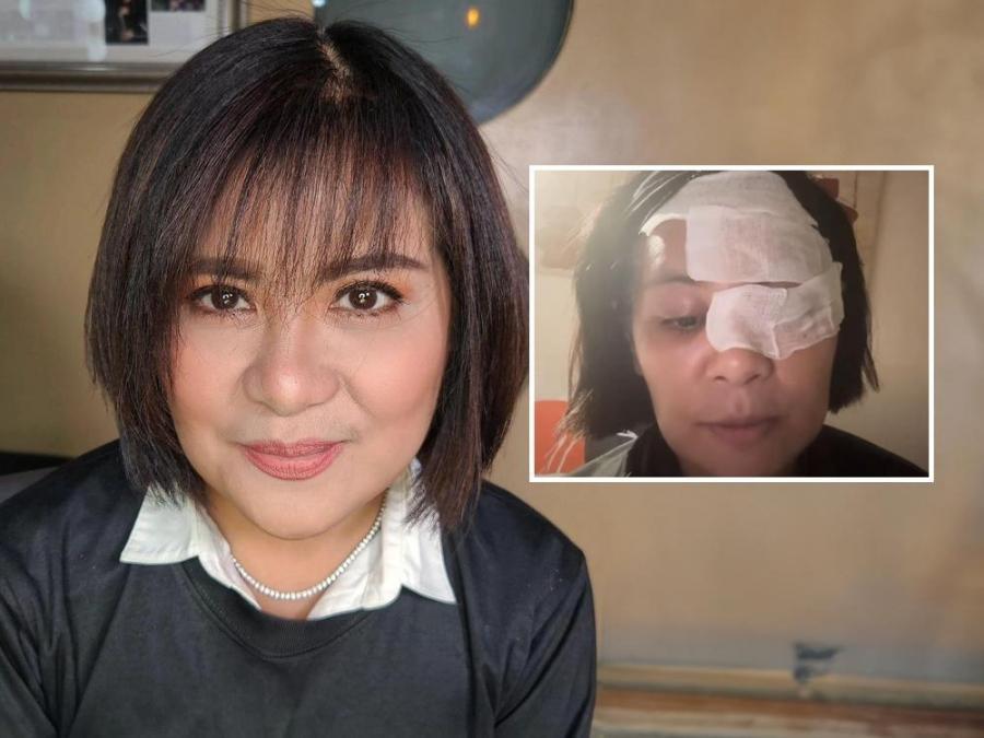 Candy Pangilinan, na-diagnose na may shingles | GMA Entertainment