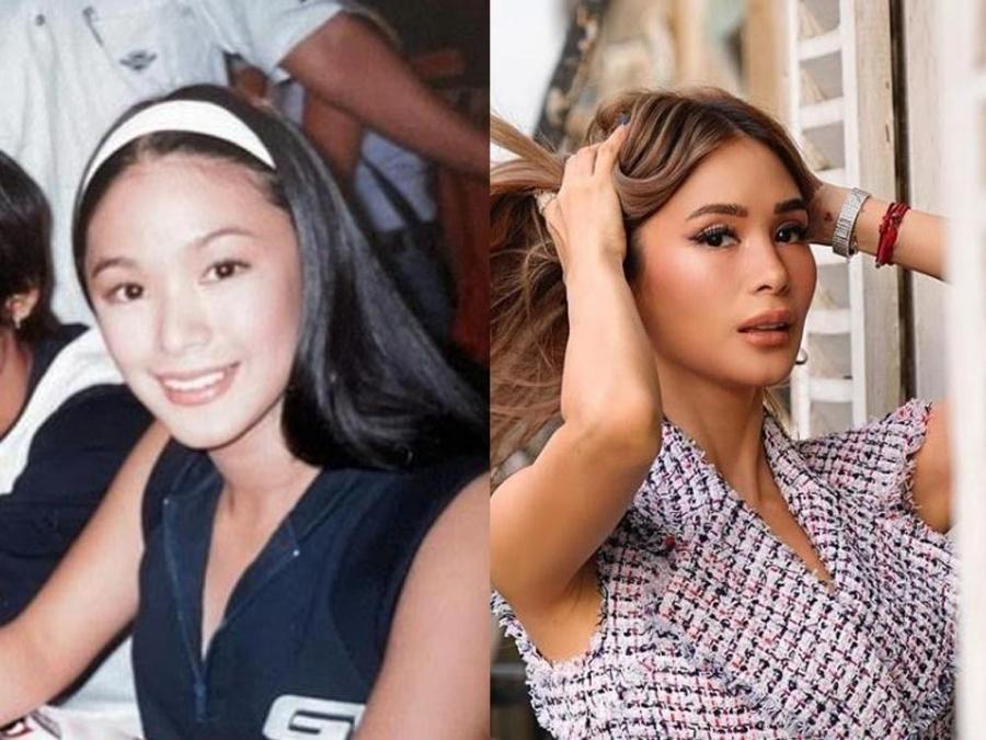 heart evangelista before and after｜TikTok Search