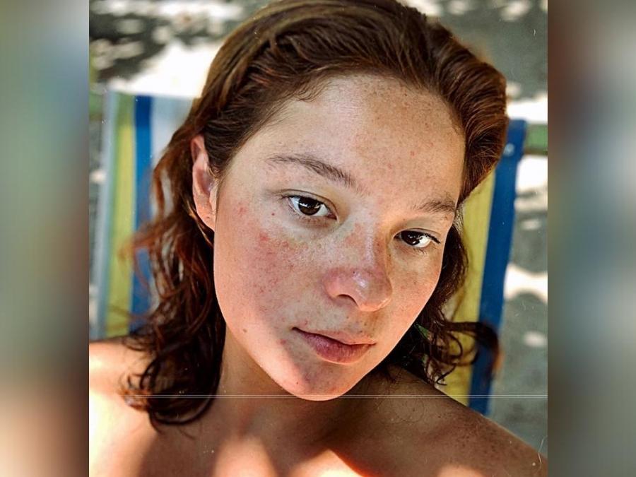 Andi Eigenmann shares the improvement of her weight loss journey through he...