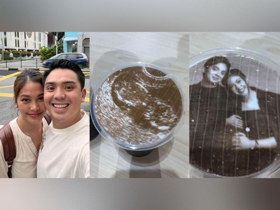 Sef Cadayona and non-showbiz partner are expecting first child | GMA ...