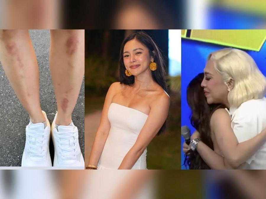 Vice Ganda to Kim Chiu: 'Ipagtatanggol kita, ipaglalaban kita' | GMA  Entertainment