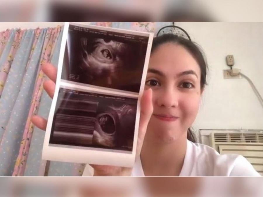 Vaness del Moral holding her sonogram