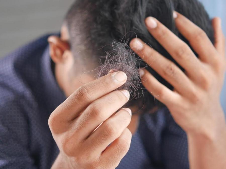 Ask Dr. Jean: Why Has My Hair Started Falling Off Since The Pandemic  Started?