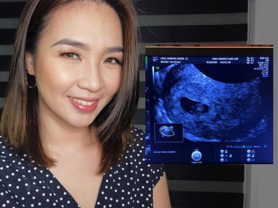 Maricris Garcia and her sonogram