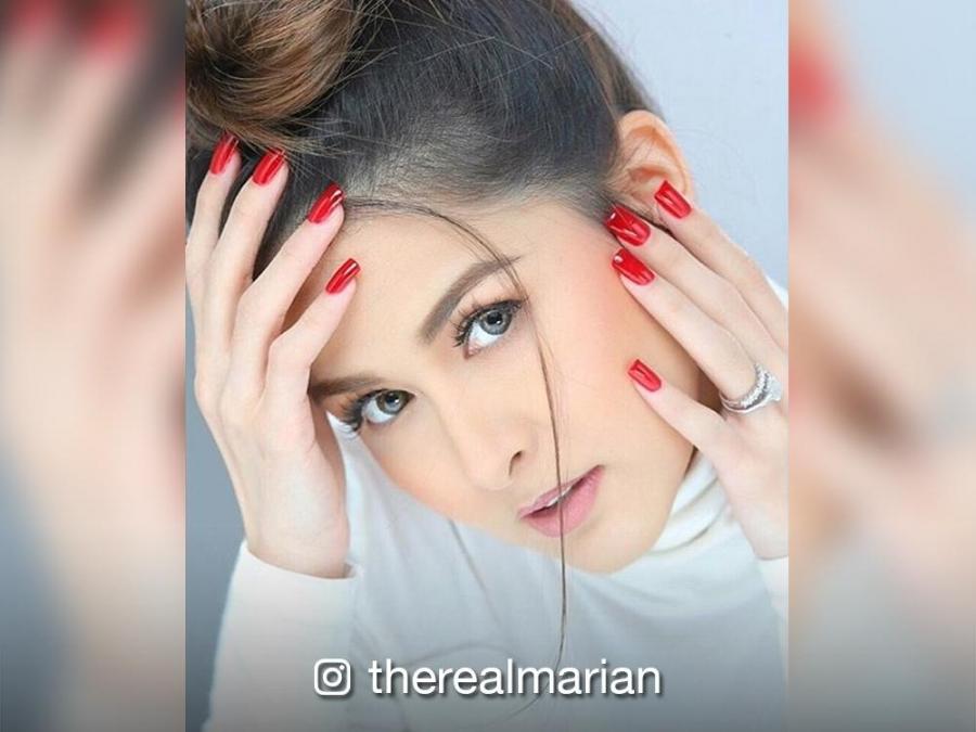 LOOK Marian Rivera brings smiles to children with cleft lip and palate