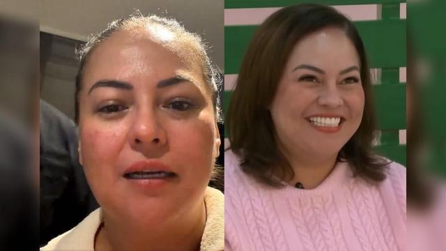 Karla Estrada on plastic surgery rumor: 'Ano ba 'yung nagbago?'