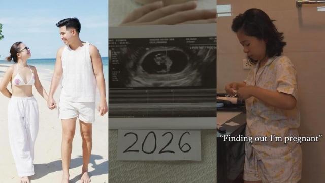 Kiray Celis and Stephan Estopia are expecting their first child