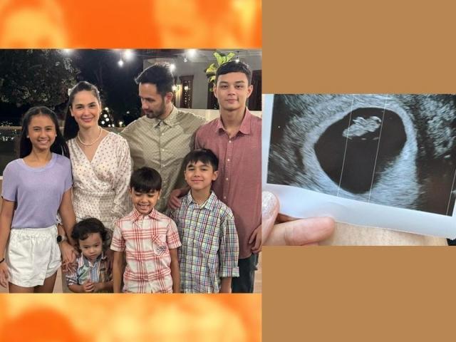 Oyo Sotto and Kristine Hermosa