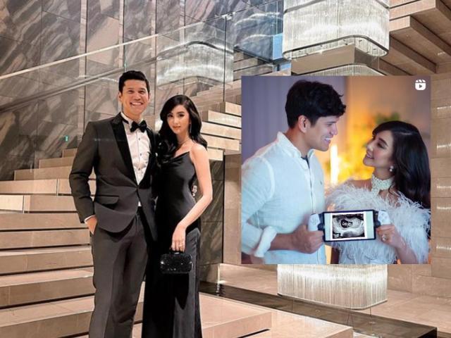 Alodia Gosiengfiao and 