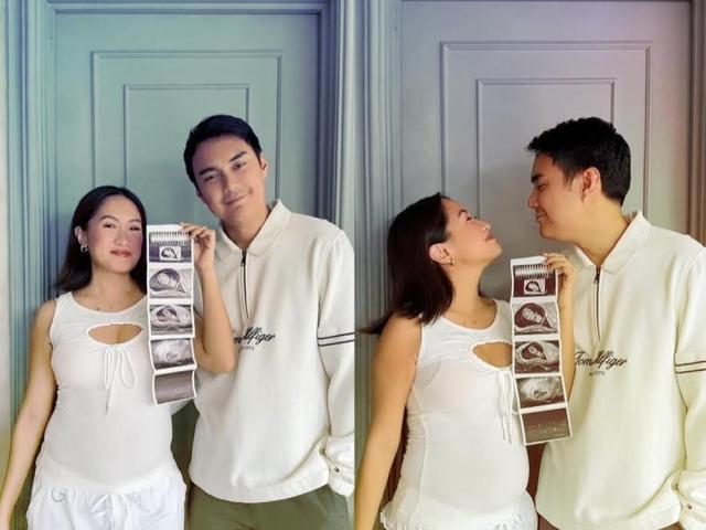 Laureen Uy and her husband Miggy Cruz holding a sonogram