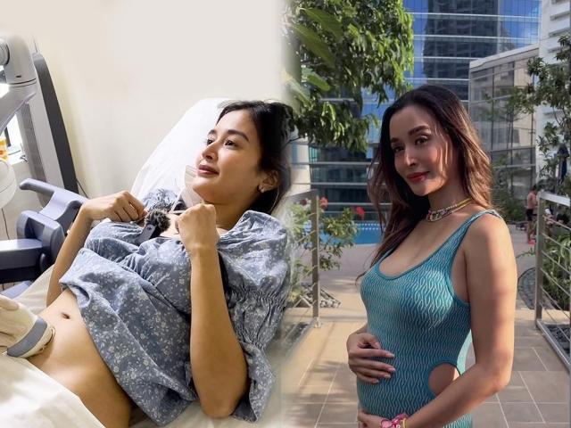 Kris Bernal