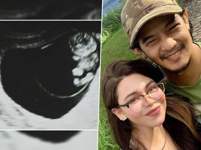 Romnick Sarmenta and Barbara Ruaro pregnancy journey