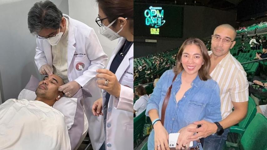 Filipino celebrities who had Bell's Palsy