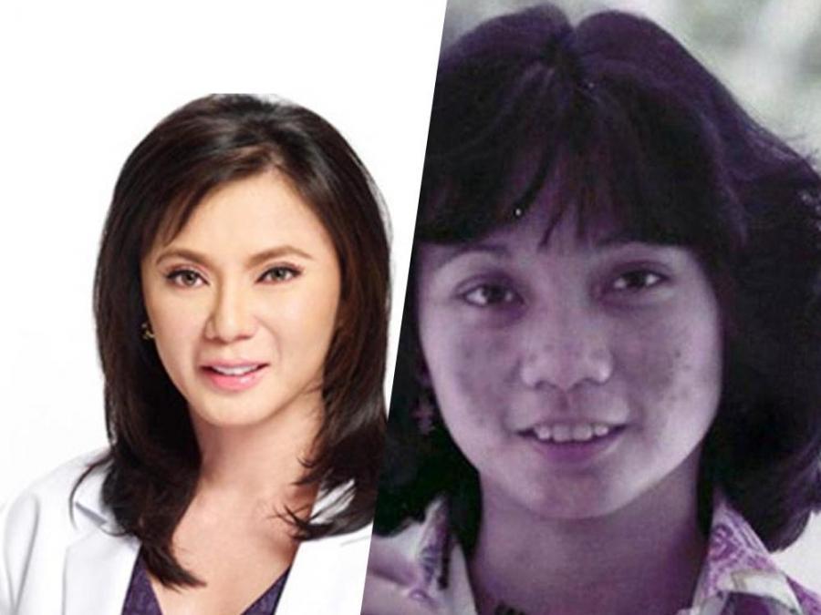 IN PHOTOS Dra Vicki Belos Transformation Celebrity Life GMA.