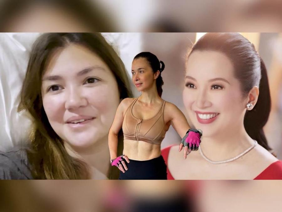 Pinoy celebrities na may rare medical conditions