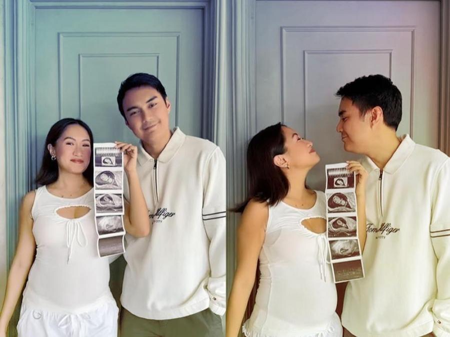Laureen Uy and her husband Miggy Cruz holding a sonogram