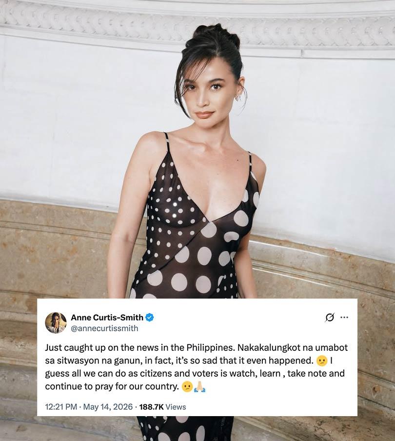 Anne Curtis