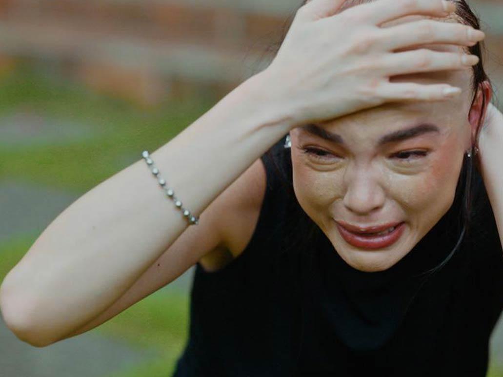 May sakit na alopecia si Margaret