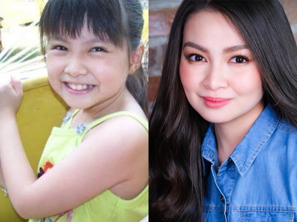 Barbie Forteza