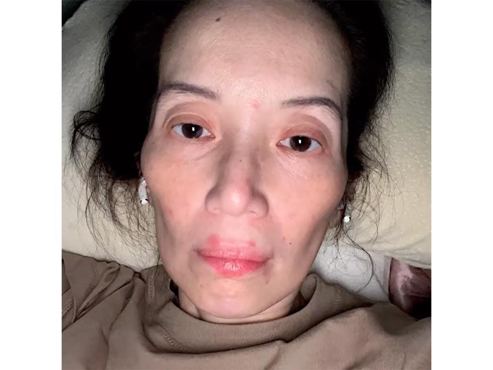 Kris Aquino has lupus flare fever; develops joint pain, rashes all over body | GMA Entertainment
