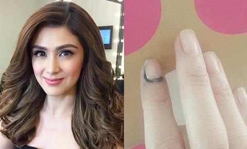 Carla Abellana