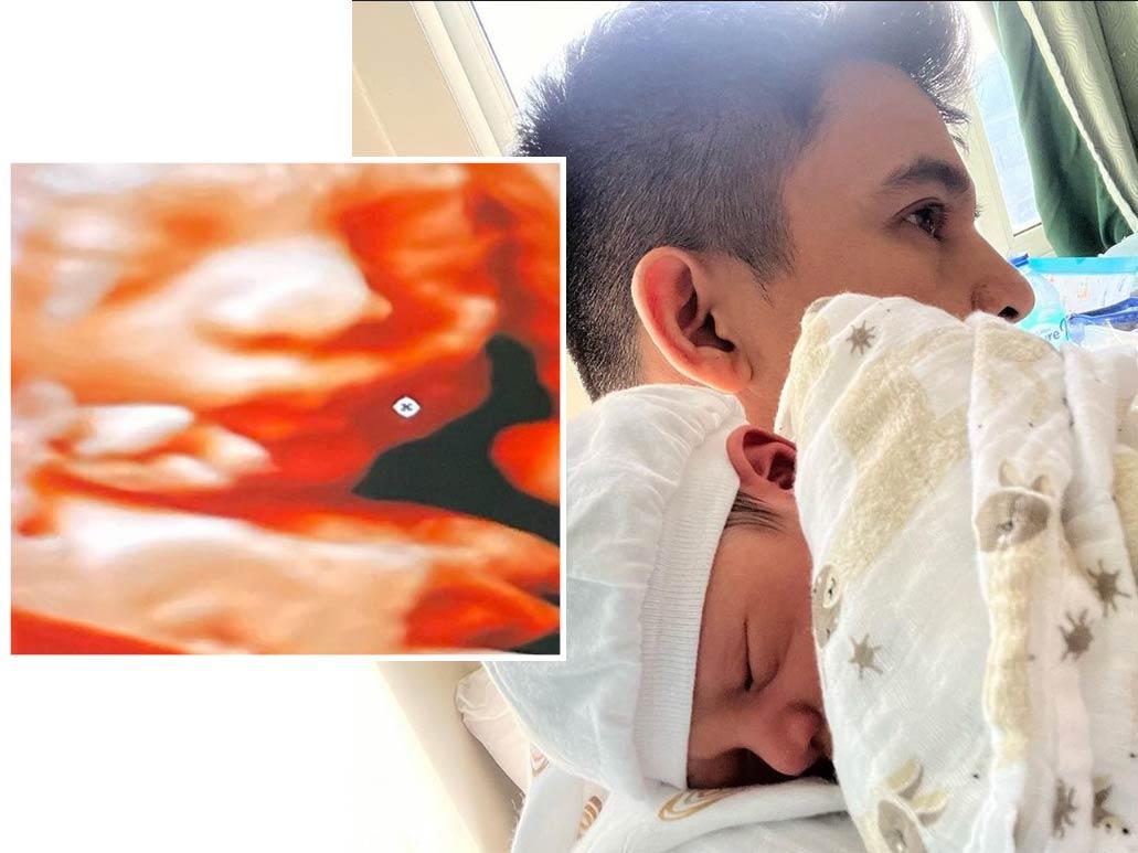 Knoa Alexander R. Abalos