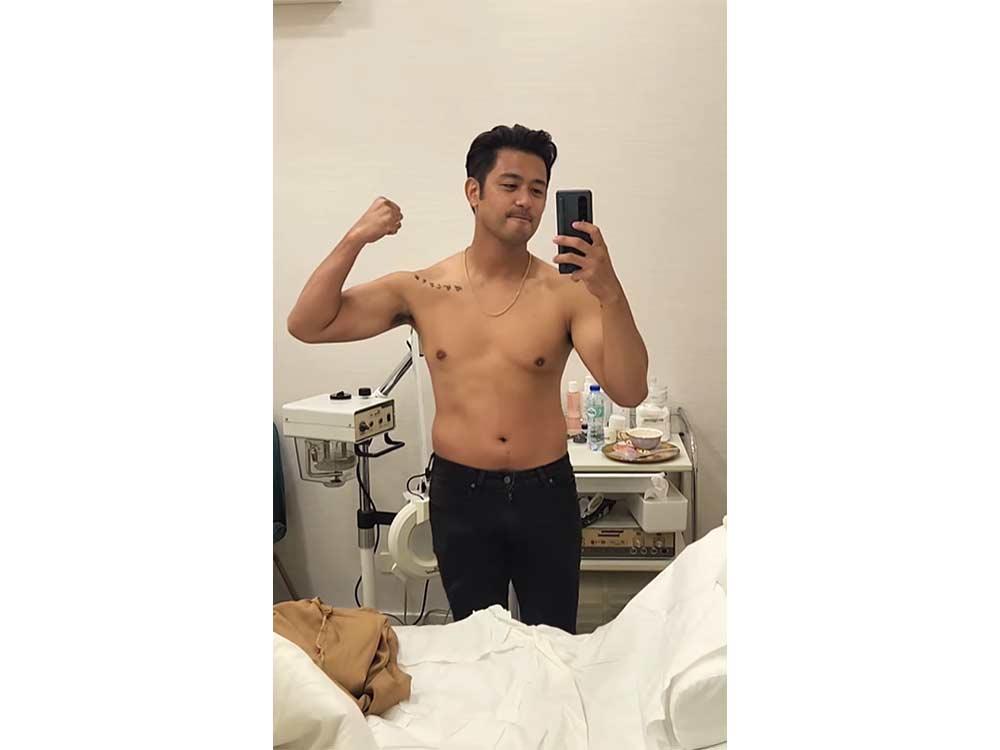 Rocco Nacino