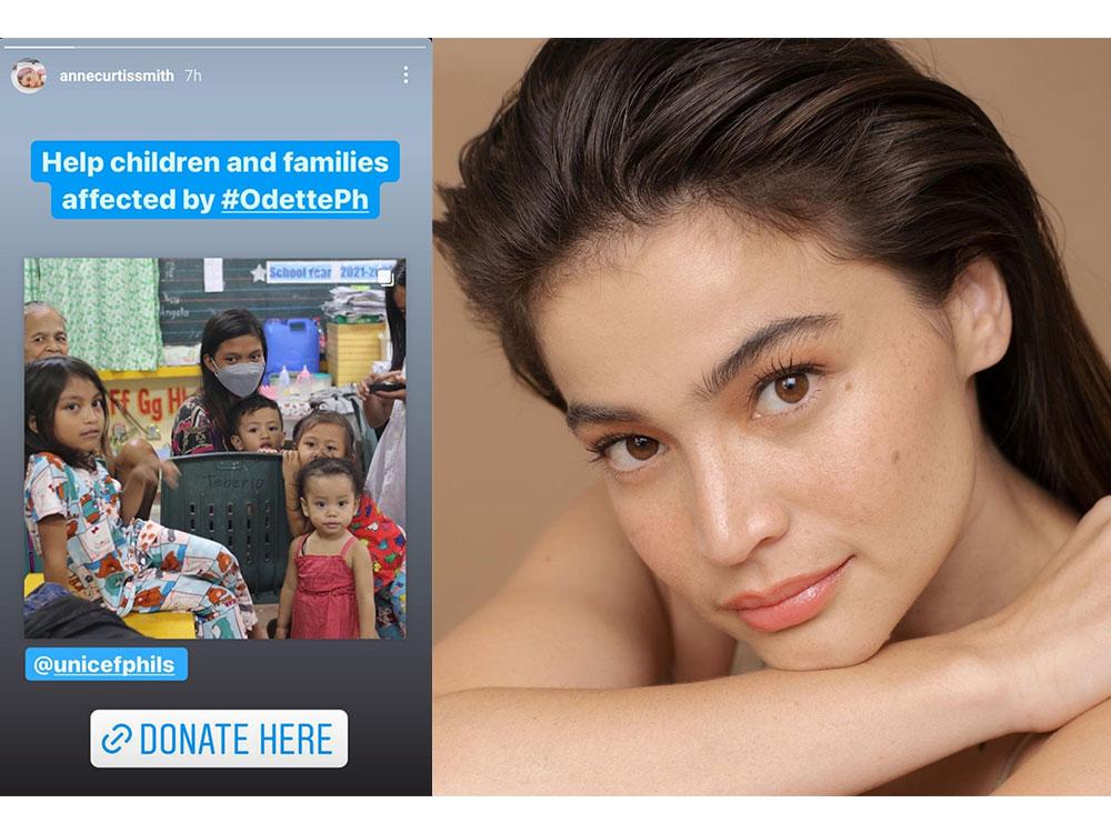 Anne Curtis